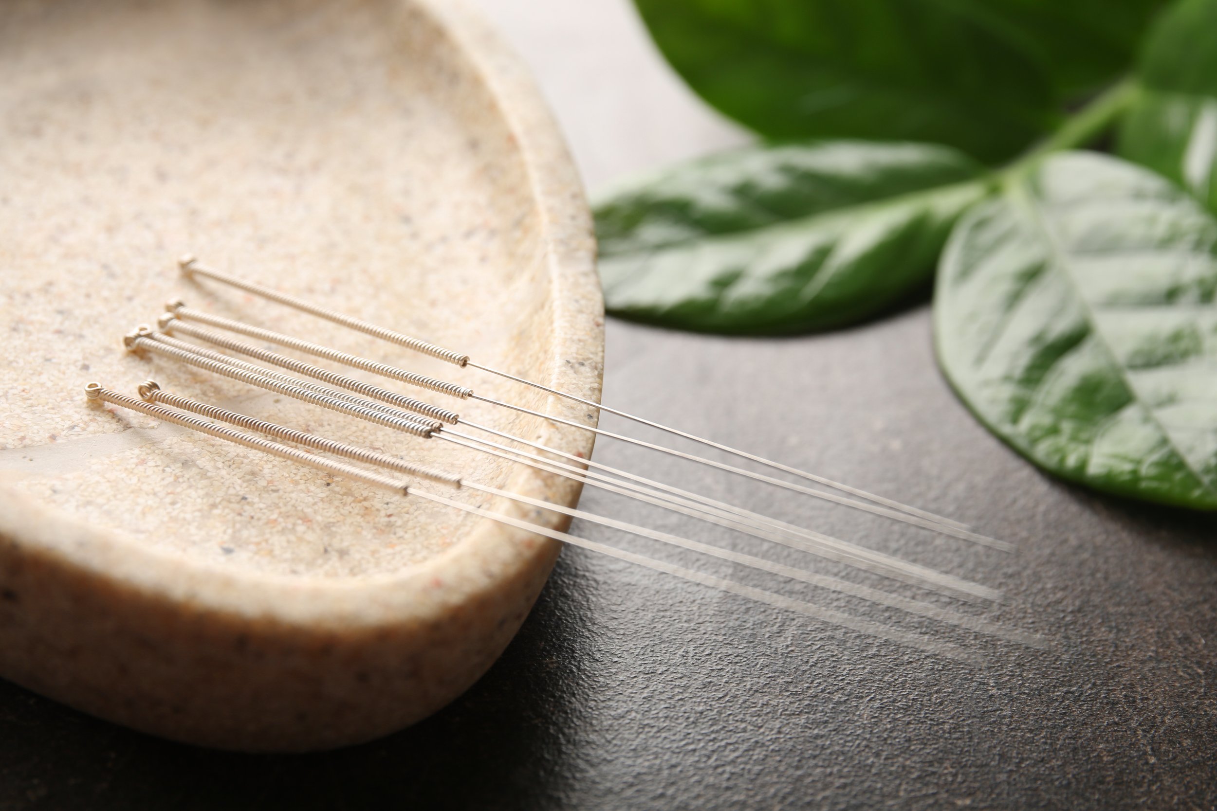 Acupuncture for focus